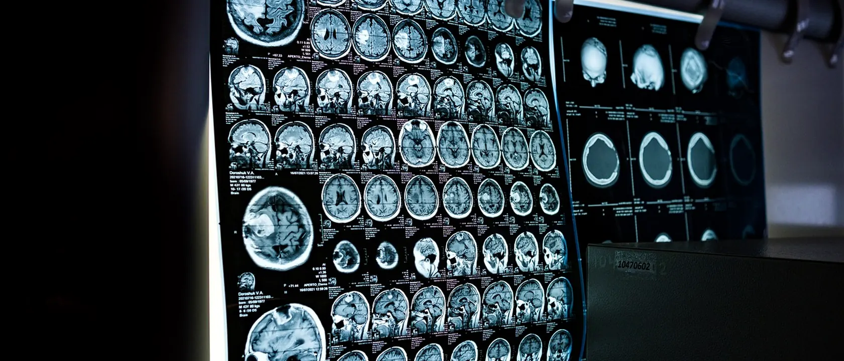 Neurologists